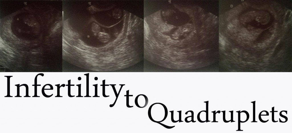 Infertility to Quadruplets